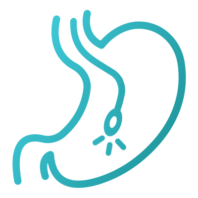 Эндоскопия